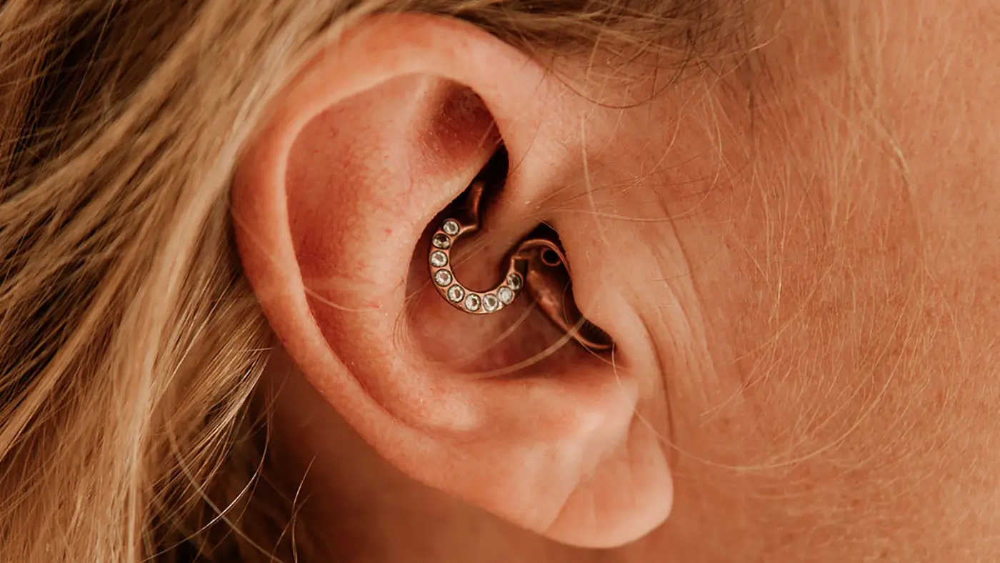 Nahaufnahme eines Ohrs, in das ein In-dem-Ohr-Hörgerät eingesetzt ist.