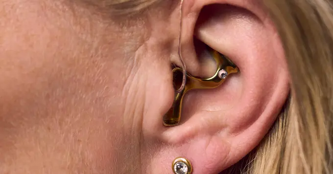 Nahaufnahme eines Ohrs mit einem Otoplastik-Hörgerät.